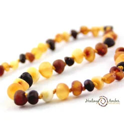Teething Necklaces|Healing Amber Baltic Amber Teething Bracelets - 5.5 inches