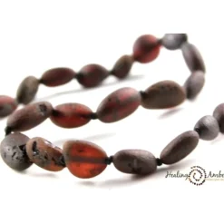 Teething Necklaces|Healing Amber Baltic Amber Teething Necklace - 17.5 Inch